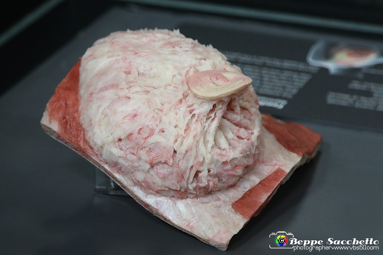 VBS_2540 - Ghiandola Mammaria - Mostra Body Worlds.jpg